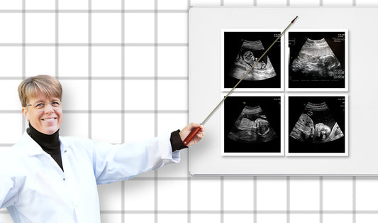 dr elin östman pekar med pekpinne på ultraljudsbilder på foster där mamman har graviditetsdiabetes